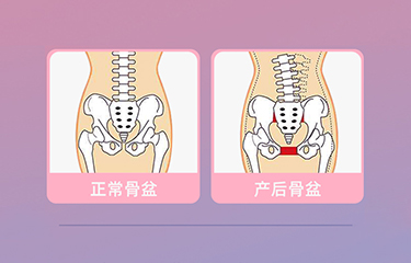 盆底肌修復儀器怎么樣？哪些人可以使用它呢